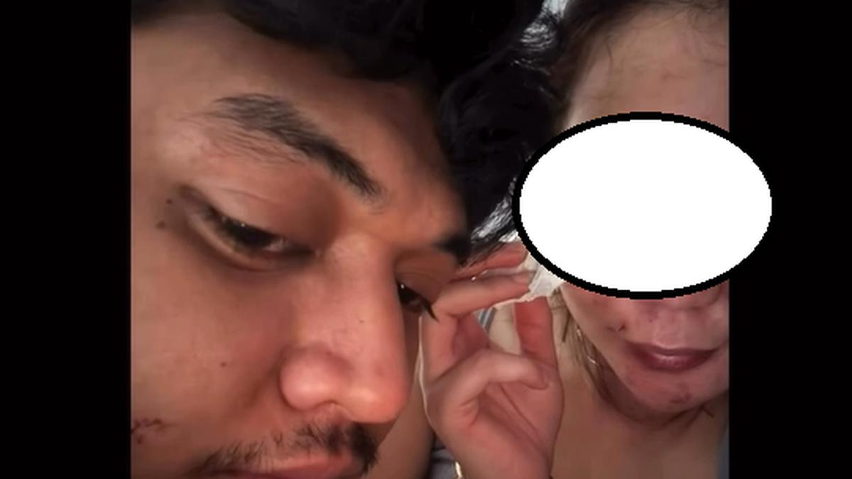 Fakta Baru Pria di Malang Aniaya DJ Wanita, Pelaku Cemburu Korban Disawer