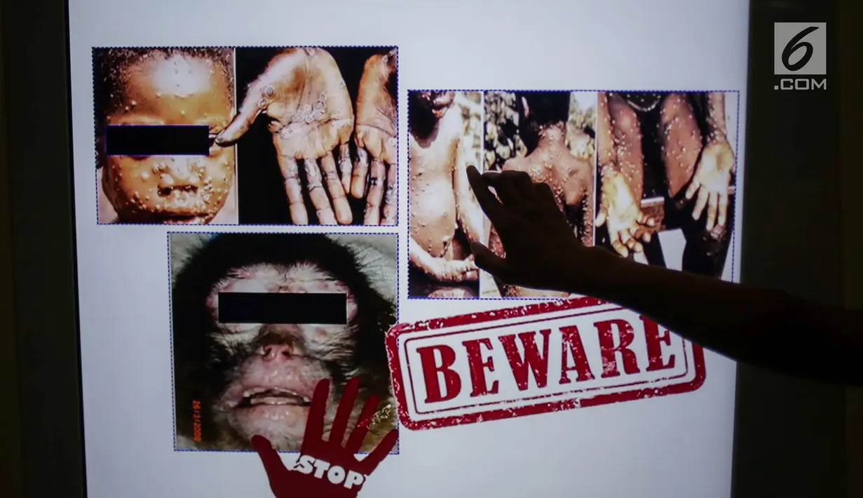 Informasi tentang cacar monyet atau monkeypox dipasang di Terminal 3 Bandara Soekarno Hatta, Tangerang, Banten, Rabu (15/5/2019). Cacar monyet merupakan penyakit langka yang disebabkan virus. (Liputan6.com/Faizal Fanani)