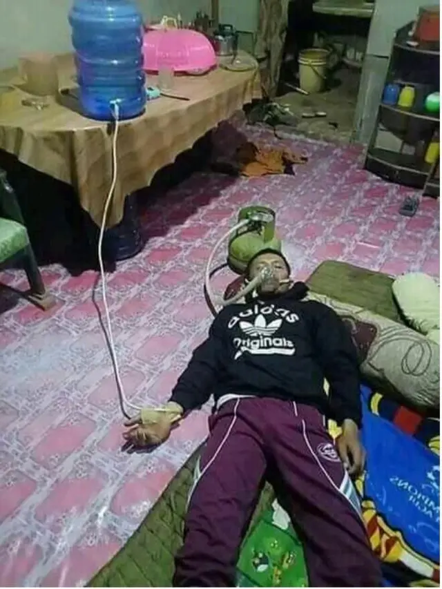 6 Tingkah Nyeleneh Pura-Pura Sakit Ini Absurd Banget, Kocak