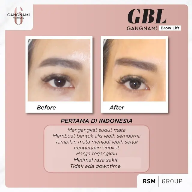 Perawatan Alis Mata Gangnam Brow Lift Makin Banyak Diminati