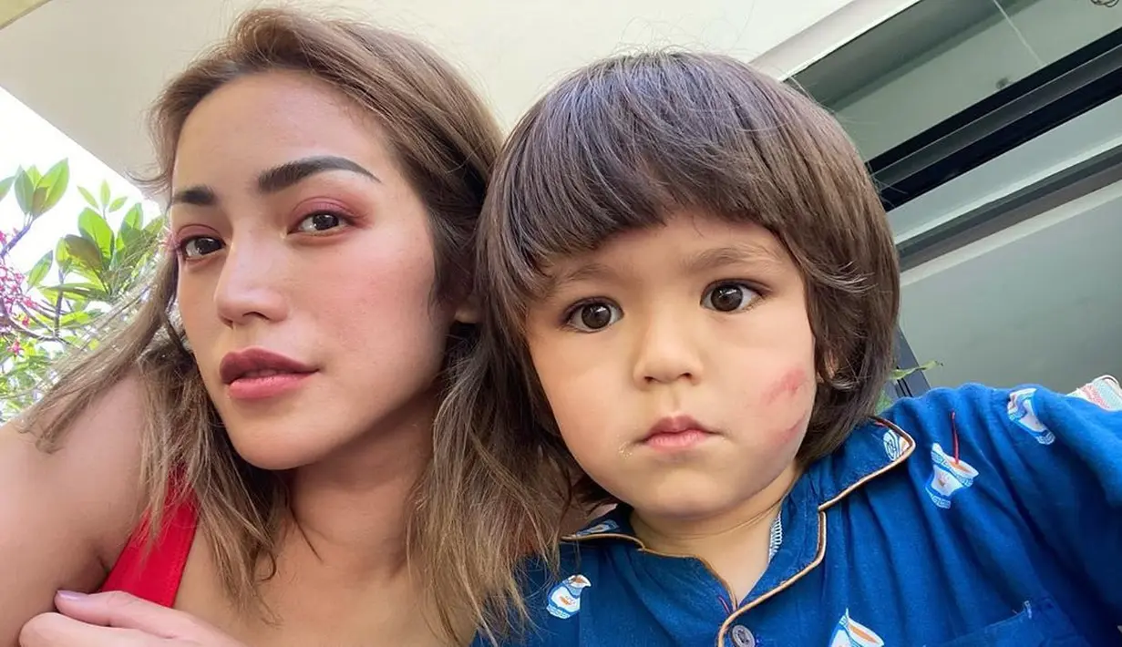 Lewat akun Instagramnya, Jedar menceritakan efek yang dirasakan dari penyakitnya ini. Emosi yang terkuras dan terkadang ia merasa tak berguna dalam hidup. Tak jarang juga ia merasa jantung berdebar, sakit perut dan membuatnya lemas. (Instagram/inijedar)