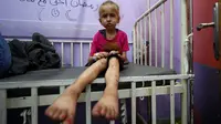 Dia mengatakan bahwa 1 dari 6 anak di bawah usia dua tahun mengalami malnutrisi akut di Gaza utara. (Bashar TALEB / AFP)