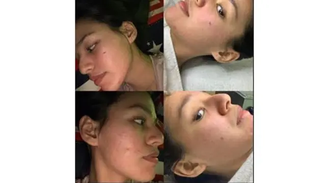Menangis Karena Wajah Rusak, Ini 6 Potret Terbaru Susan Sameh