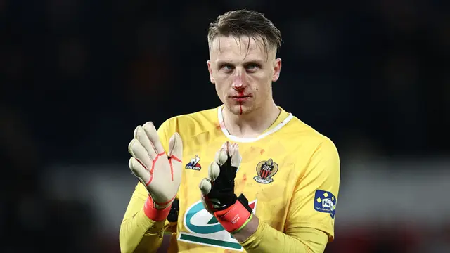 Foto: Wajah Kiper Marcin Bulka Babak Belur saat Nice Dihajar PSG di Perempat Final Coupe de France