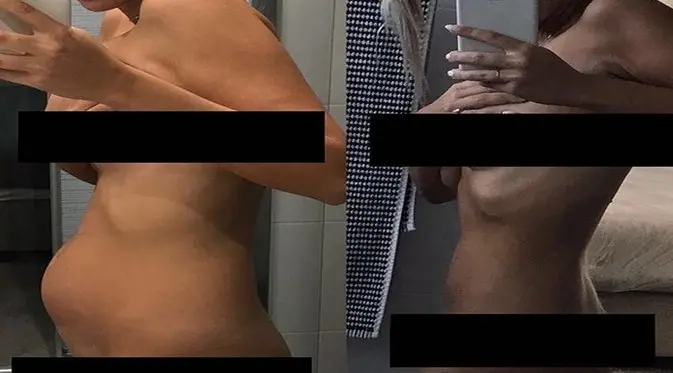 Foto tubuh Thessy yang mengalami menopause dini (kanan) terkait kondisi endometriosis yang dialaminya. (Foto: Instagram Thessy)