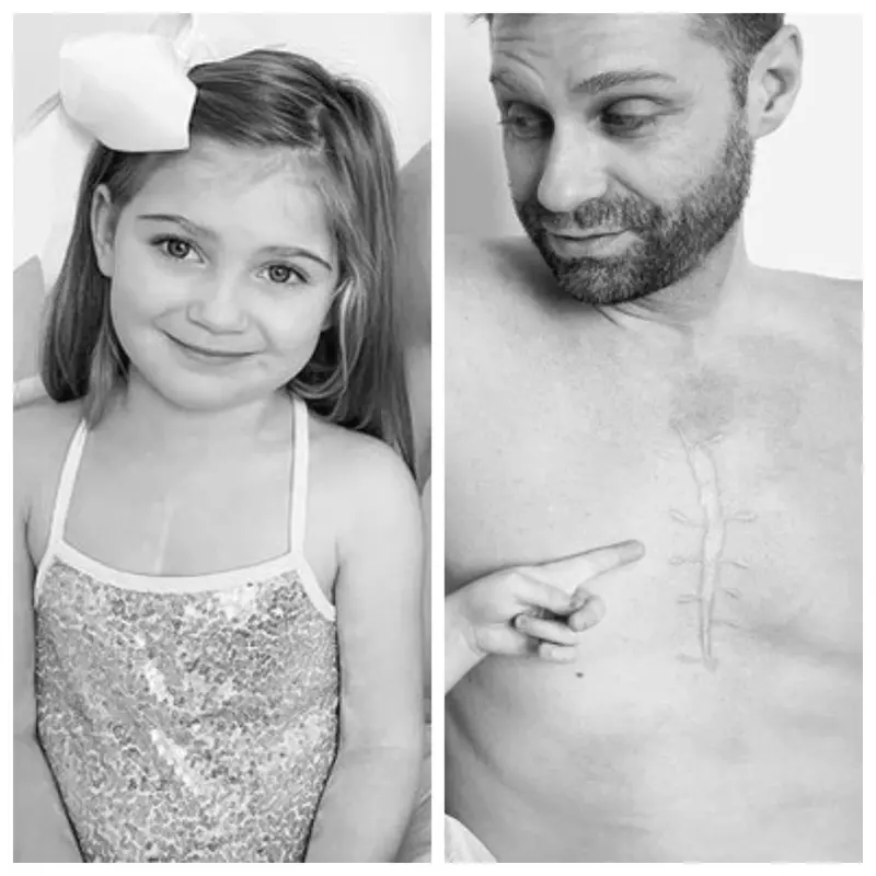 Pria Ini Buat Tato yang Mirip Bekas Luka Operasi Jantung Sang Putri, Bikin Haru