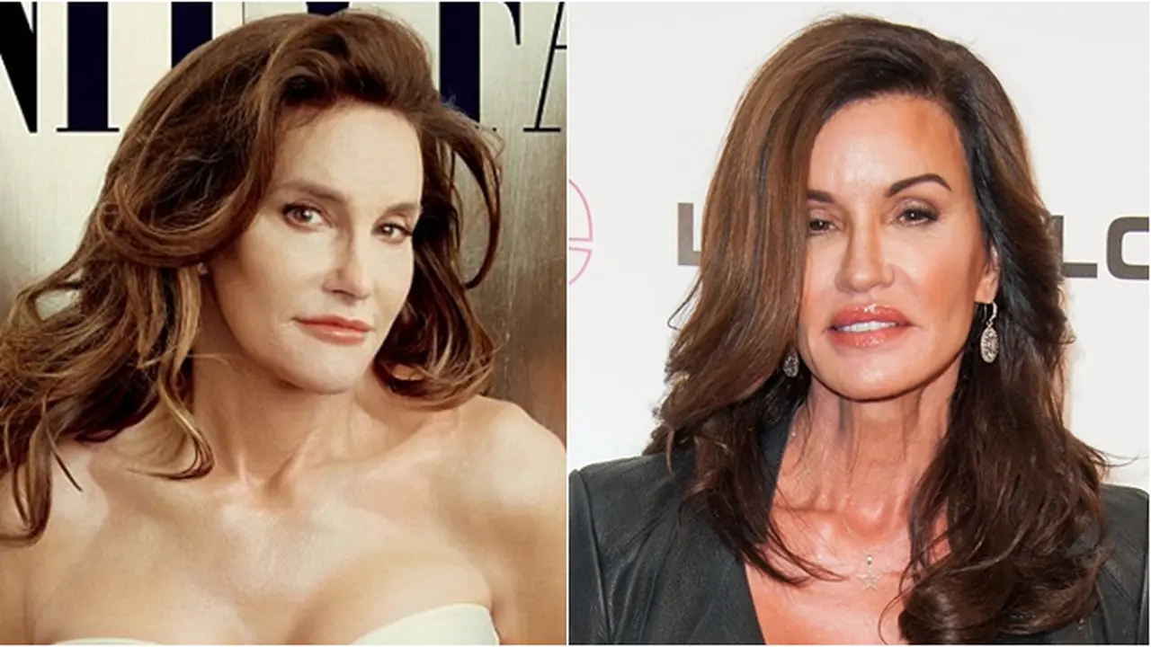 Bruce Jenner a.k.a Caitlyn Jenner vs Janice Dickinson