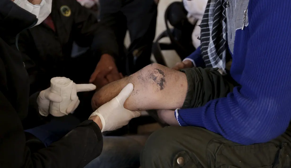 Khamis (kiri) melihat kondisi kaki seorang pria yang di amputasi, kota Maaret al - Numan di provinsi Idlib , Suriah 20 Maret 2016. Daerah ini merupakan daerah konflik yang mana warganya banyak yang menjadi korban. (REUTERS / Khalil Ashawi)