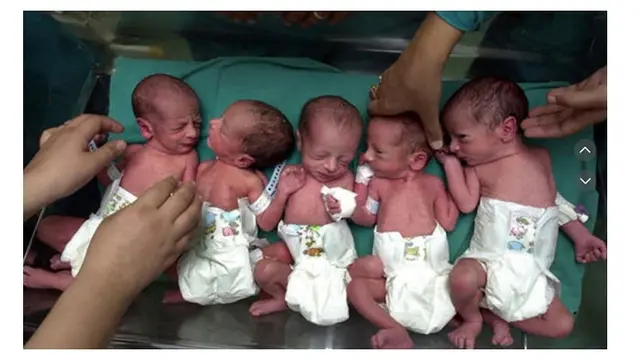 Viral Tahun 2016, Ini 6 Potret Transformasi Bayi Kembar Lima yang Ultah ke-8
