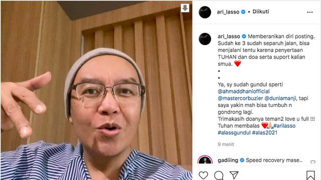 Jalani Kemoterapi, Ari Lasso Pangkas Habis Rambutnya Hingga Gundul. (instagram.com/ari_lasso)