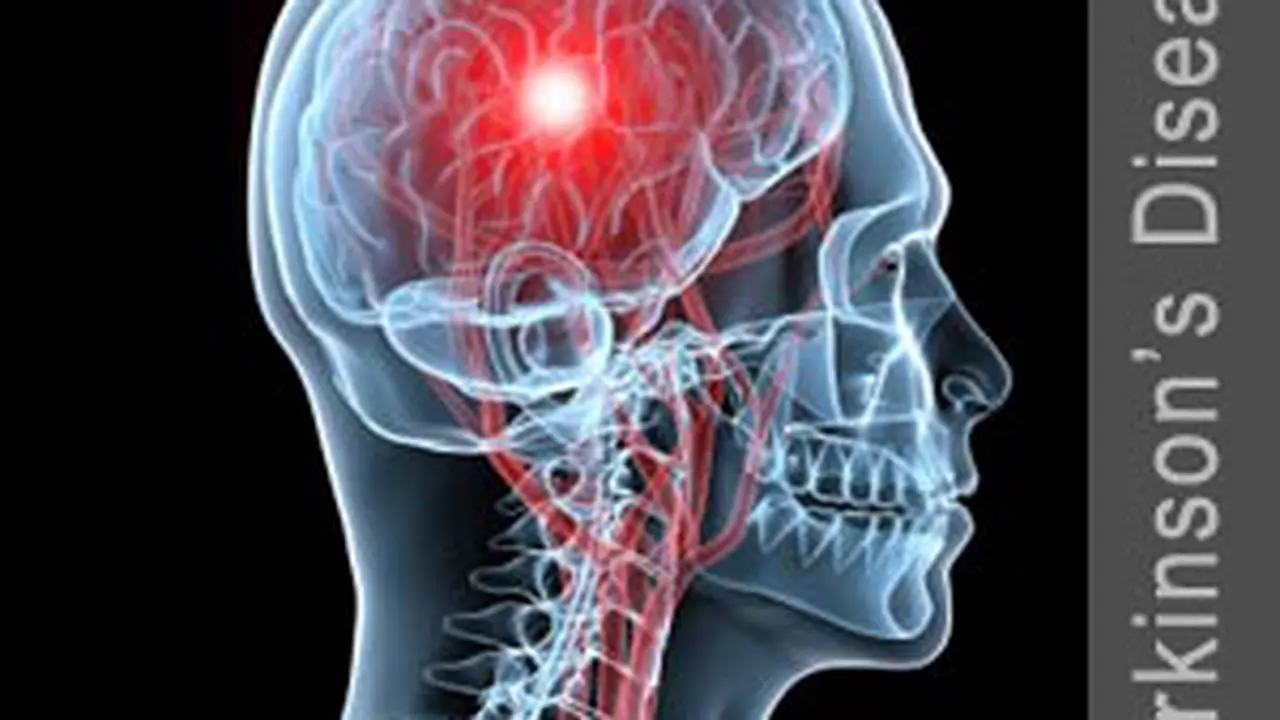 Parkinson