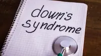 6 Masalah Kesehatan yang Menimpa Anak Down Syndrome (MsMaria/Shutterstock)