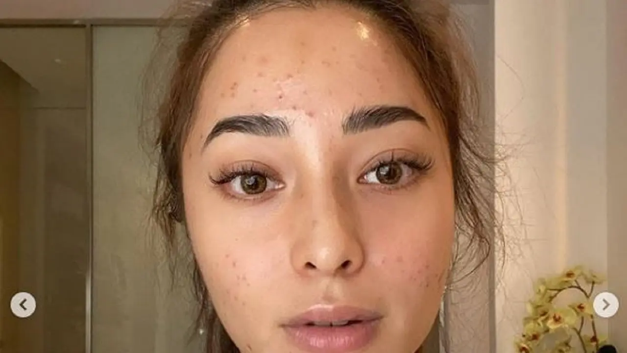 Nikita Willy