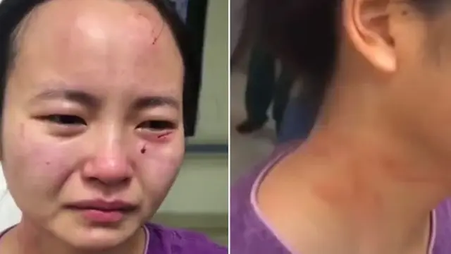 Tak Mau Dirawat, Kisah Perawat Diserang Pasien Corona Covid-19 Ini Bikin Haru