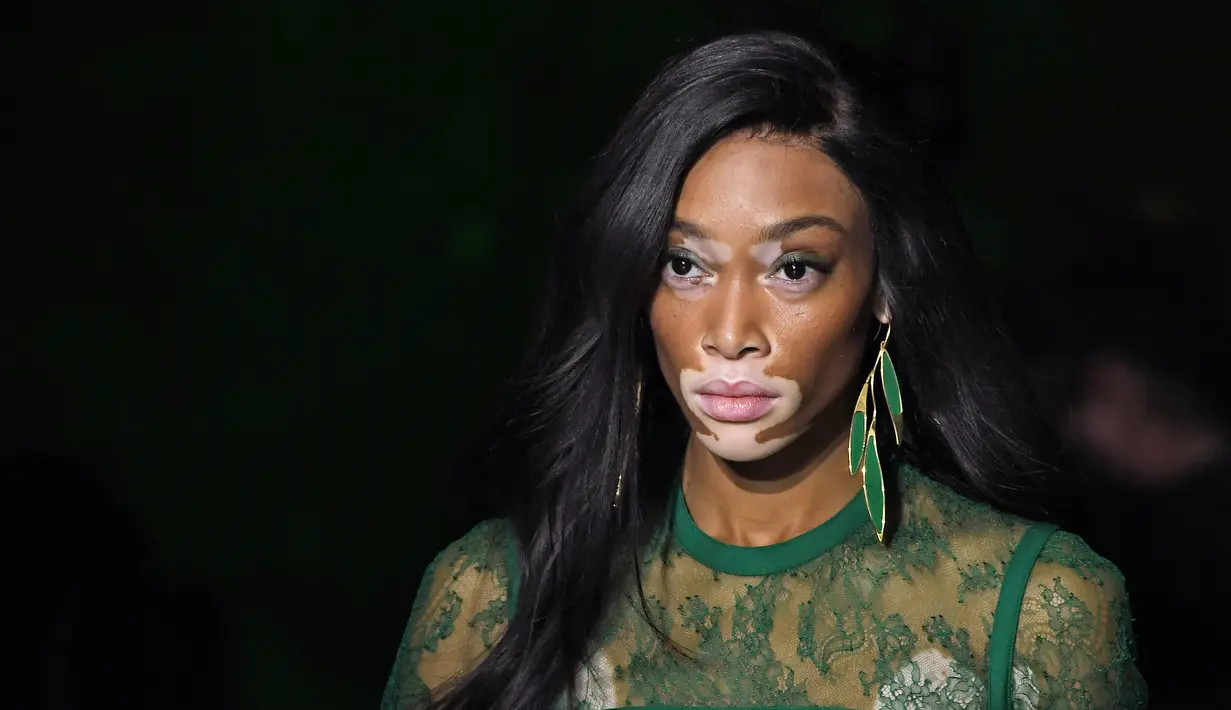 Model bernama Winnie Harlow menampilkan koleksi Spring/Summer 2018 untuk Elie Saab selama Paris Fashion Week, Minggu (1/10). Selain bersinar di dunia mode, Winnie juga aktif menjadi pembicara mewakili penderita vitiligo. (ALAIN JOCARD / AFP)