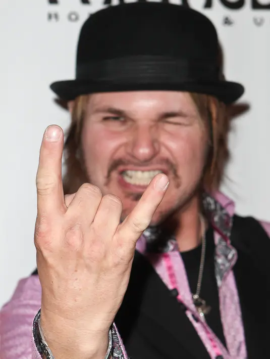 Meskipun penyakit yang menimpanya ini masih dikategorikan ‘dapat sangat diobati’, Rikki Rockett telah mengalami sekumpulan gejala yang menyakitkan semenjak ia didiagnosis yang memberi pengaruh besar pada tubuhnya. (AFP/Bintang.com)
