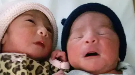 Unik Banget Bayi Kembar Lahir Bersamaan Di Tahun Yang Berbeda Parenting Fimela Com