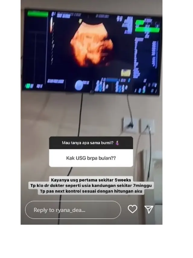 6 Potret Ryana Dea Umumkan Kehamilan Ketiga, Sudah Pamer Baby Bump
