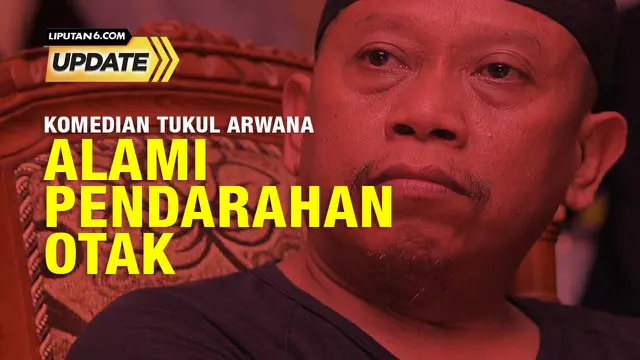 Liputan 6 Update:  Kondisi Terkini Pelawak Tukul Arwana, Usai Mengalami Pendarahan Otak