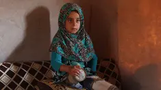 Maya Mohammad Ali Merhi (8) berpose menggunakan kaki prostetik dari kaleng di sebuah kamp orang terlantar di Provinsi Idlib, Suriah, Rabu (20/6). Kali palsu tersebut dibuat oleh sang ayah untuk Maya. (Aaref Watad/AFP)