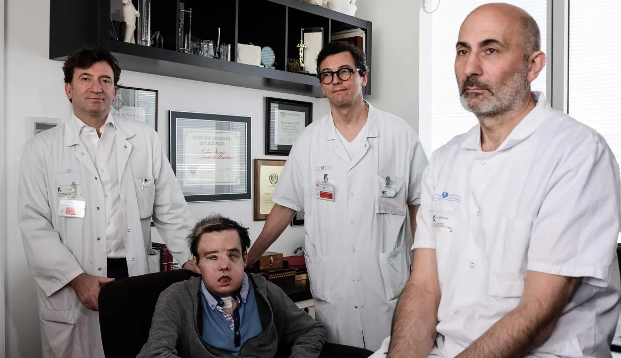 Profesor kedokteran Perancis Laurent Lantieri (kanan), seorang spesialis dalam transplantasi tangan dan wajah berpose dengan timnya dan pasien Jerome Hamon di Hopital Europeen Georges-Pompidou di Paris (13/4). (AFP Photo/Philippe Lopez)