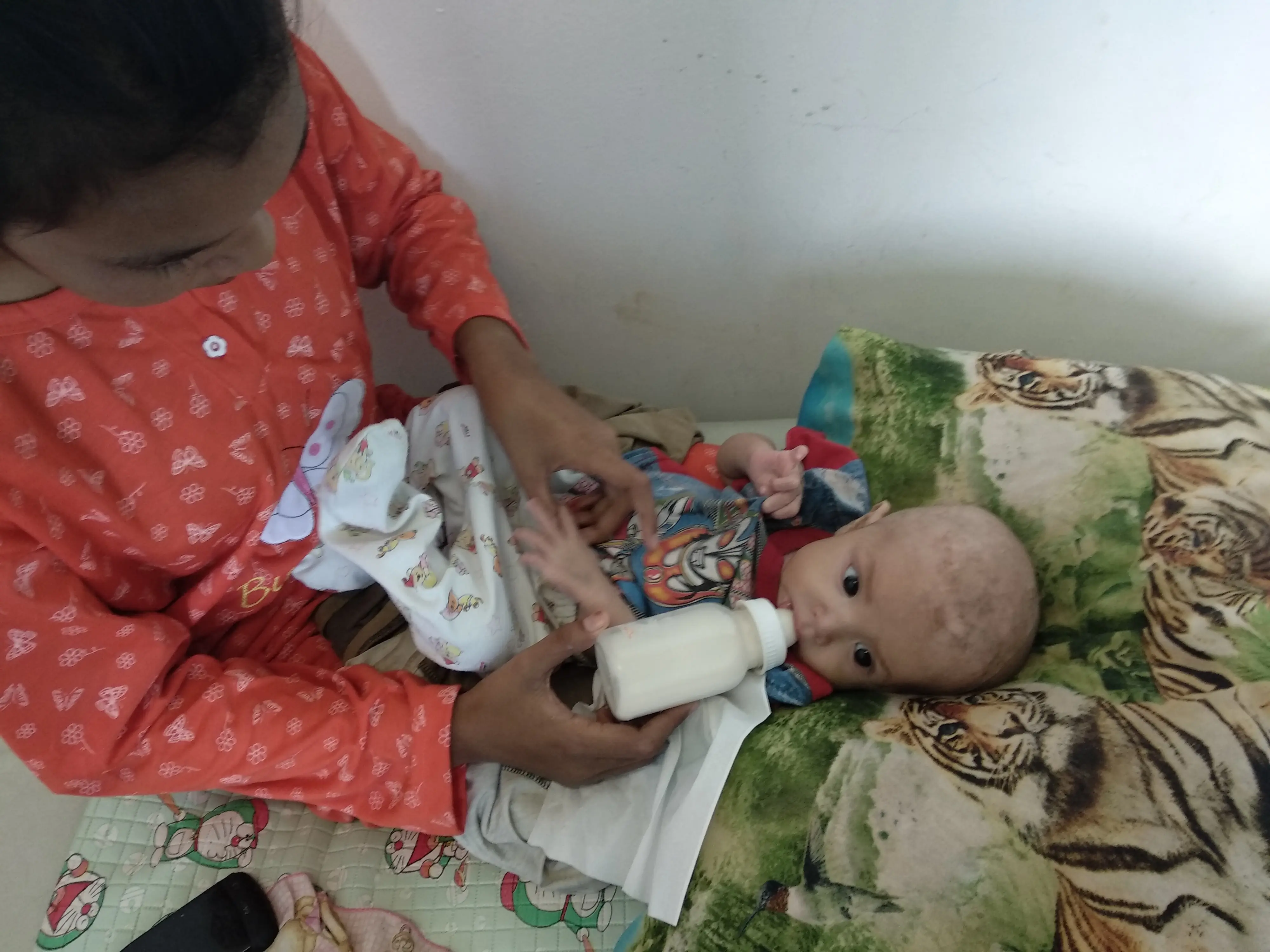 Kondisi Muhammad Adam Saputra, bayi berusia tujuh bulan yang menderita gizi buruk, sementara di rawat di RS Bahteramas Provinsi Sulawesi Tenggara. Foto: (Akbar Fua/Liputan6.com)