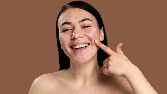 Tidak Perlu Takut Breakout, Begini Cara Aman Memilih dan Menggunakan Serum Untuk Pemula - 1