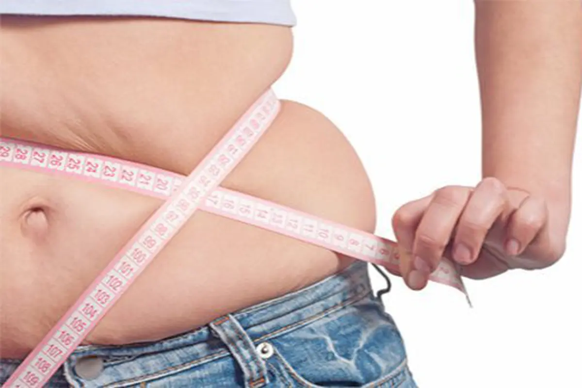 Obesitas picu kanker/copyright Shutterstock.com
