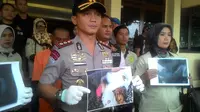 Kapolres Garut AKBP Budi Satria Wiguna menunjukan sejumlah hasil rontgen patahan tulang tangan bayi korban kekerasan di Garut (Liputan6.com/Jayadi Supriadin)