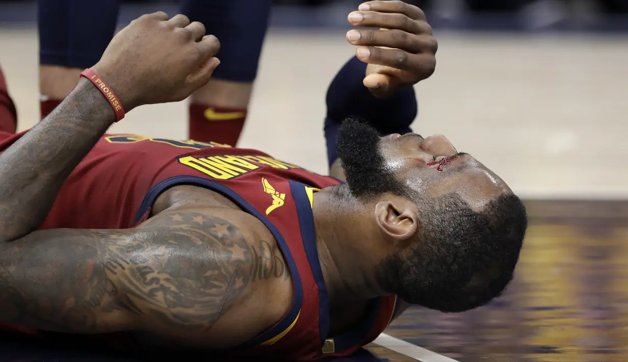 Pelipis pemain Cleveland Cavaliers, LeBron James berdarah saat berebut bola dengan pemain Indina Pacers pada game keenam playoffs NBA basketball di Bankers Life Fieldhouse, Indianapolis, (27/4/2018). Pacers menang 121-87. (AP/Darron Cummings)