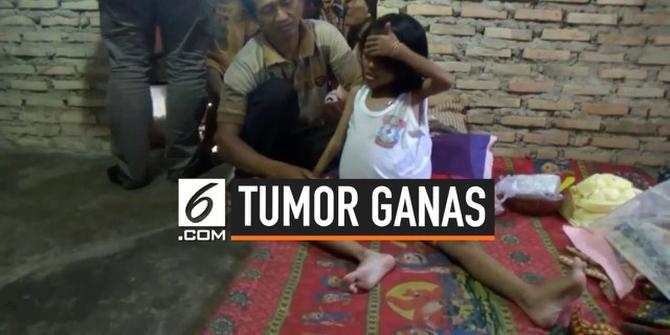 VIDEO: Derita Tumor Ganas, Bocah 6 Tahun Butuh Bantuan