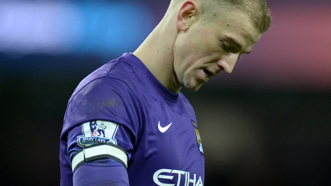 Joe Hart