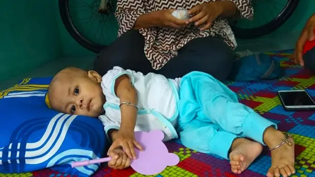 Bayi Kaina, penderita jantung bocor dirawat yang kini dirawat di Rumah Sakit Umum Daerah Arifin Ahmad Pekanbaru.