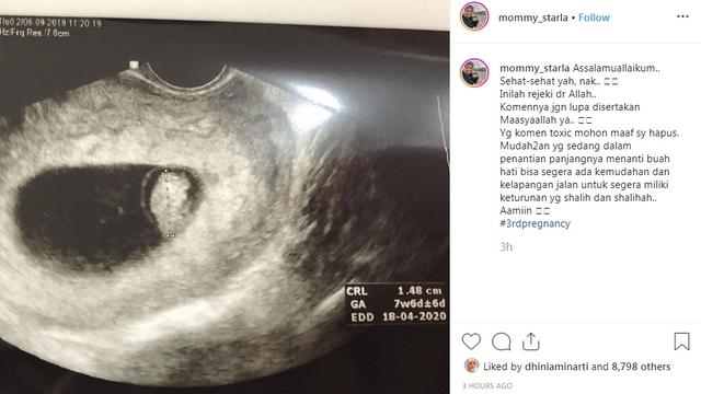 Istri Virgoun hamil lagi (Foto: Instagram/@mommy_starla)