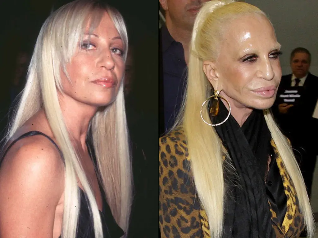 Donatella Versace Setelah Puluhan Kali Operasi Plastik. (Foto: imgur.com)