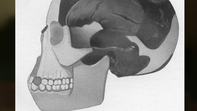 Rekonstruksi fosil Piltdown Man (Wikipedia/Public Domain)