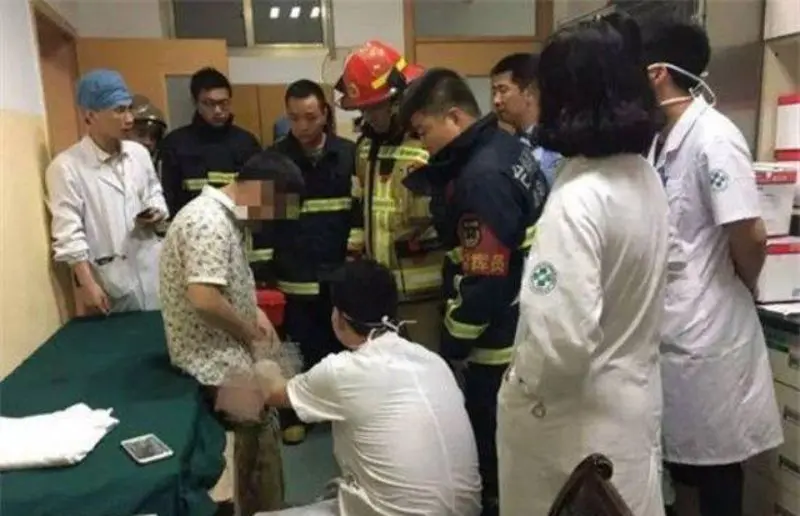Kemaluan Pria Ini Terjepit Kunci Pas selama 17 Jam. Foto: Shanghaiist