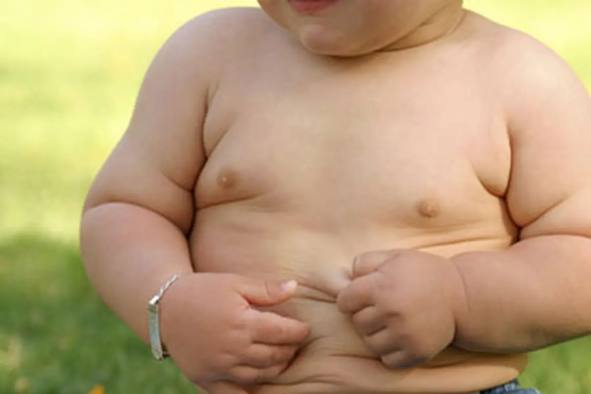 Kegemukan, Anak 12 Tahun Sudah Kena Diabetes Tipe-2