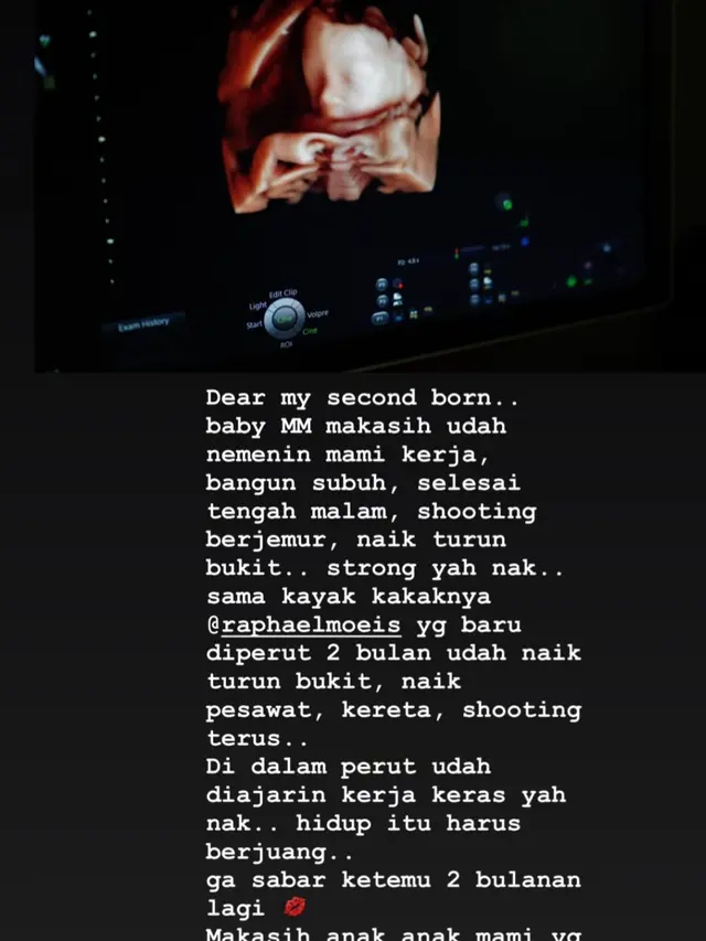 Unggahan Sandra Dewi