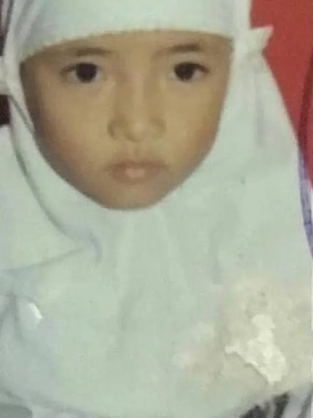 Unggah Foto Wajah Diperban dan Disebut Oplas, Ini 7 Potret Transformasi Nissa Sabyan