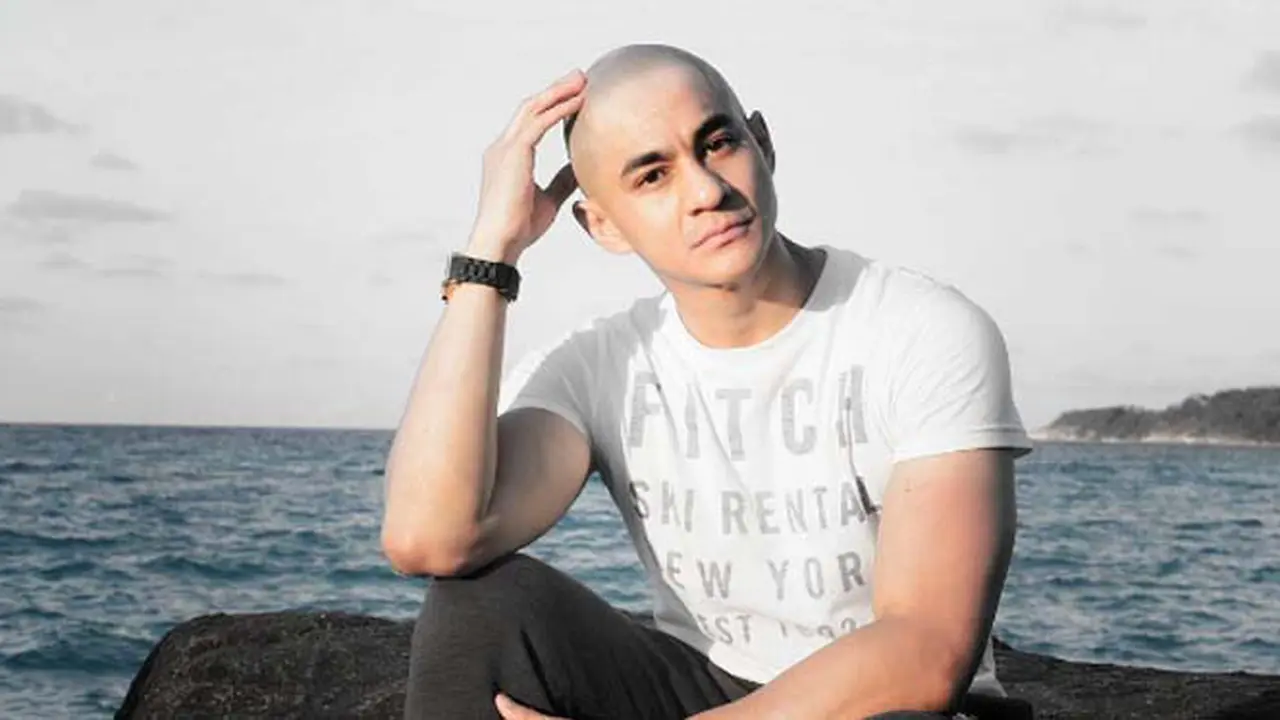 Terinspirasi Jupe, Anchor Ganteng Semangat Hadapi Alopesia
