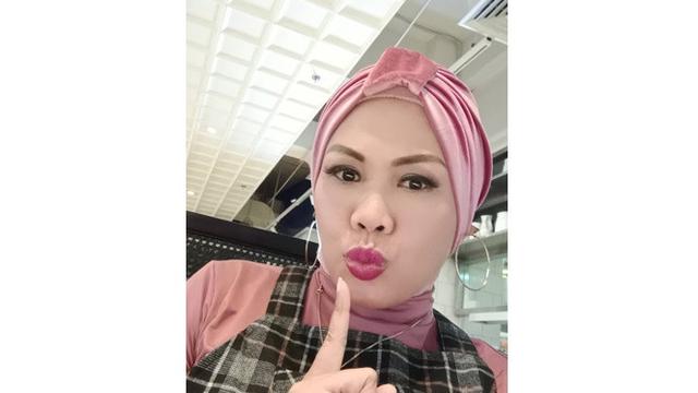 Lakukan Tanam Benang di Wajah, Ini 6 Potret Ely Sugigi Tampil Glowing