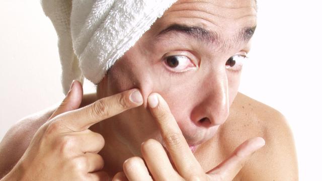 Kebiasaan Buruk Penyebab Jerawat Makin Banyak