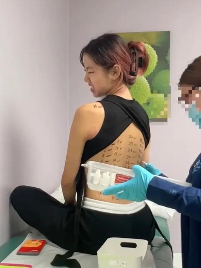 Kisah Wanita dengan 37 Alergi