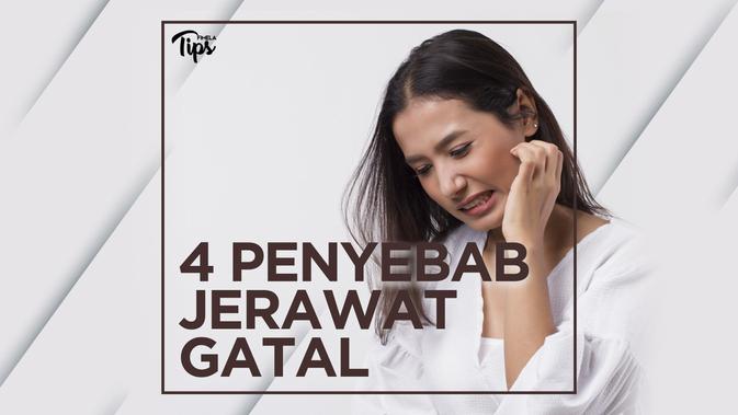 4 Penyebab Jerawat Gatal Dan Tidak Nyaman Lifestyle Fimela Com
