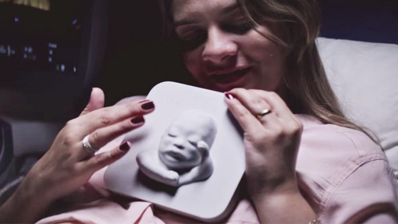 Berkat 3D, Ibu Tunanetra Ini Bisa Lihat Bayi Dalam Kandungannya