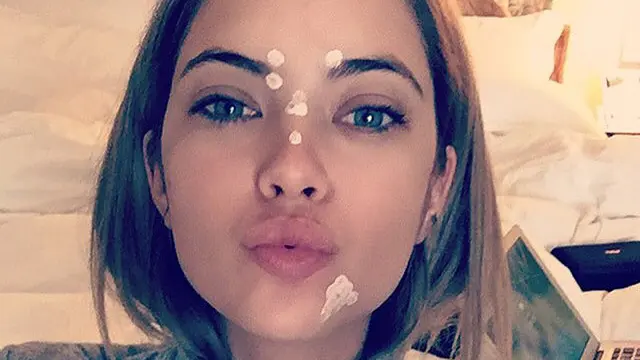 Deretan Selebritas Hollywood yang Berjuang Melawan Jerawat