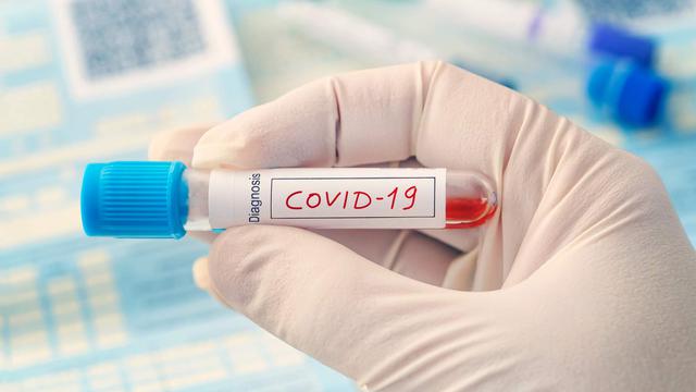 virus corona covid-19