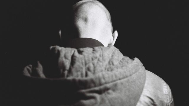 Ilustrasi pria botak, rambut rontok