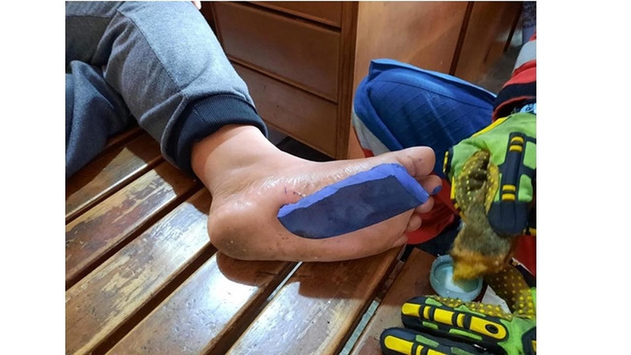 Teman Iseng Taruh Lem Korea di Sandal, Anak Ini Minta Bantuan Petugas Pemadam Kebakaran